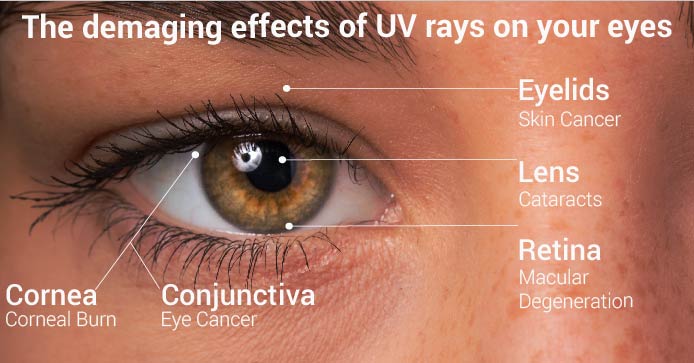 The damaging effets of UV rays on your eyes