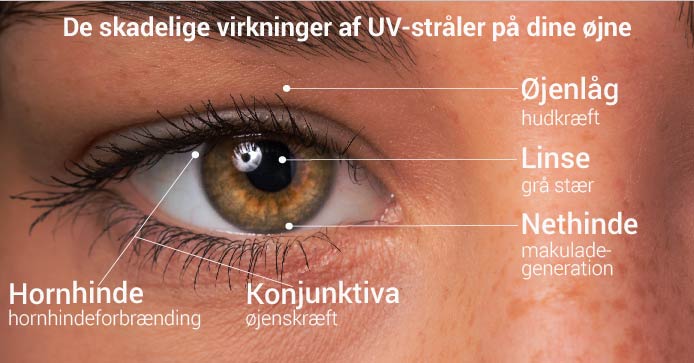 De skadelige virkninger af UV-stråler på dine øjne